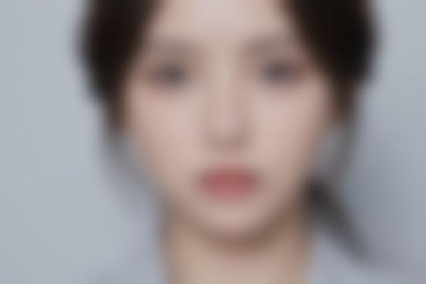 西安高一生整形医院电波拉皮项目介绍：价格、医生及优势解析