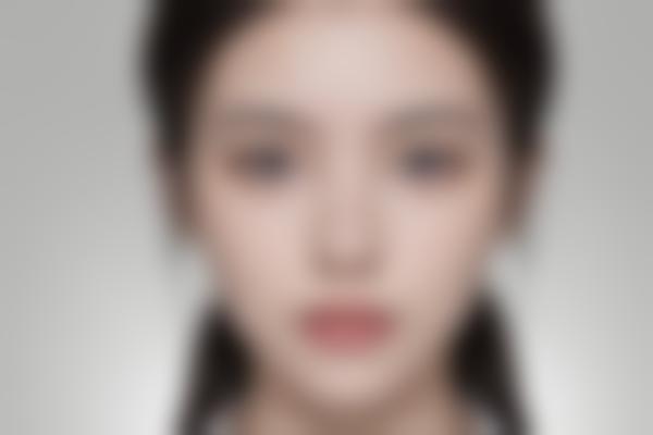 激光医疗：探索有效的皮肤年轻化解决方案