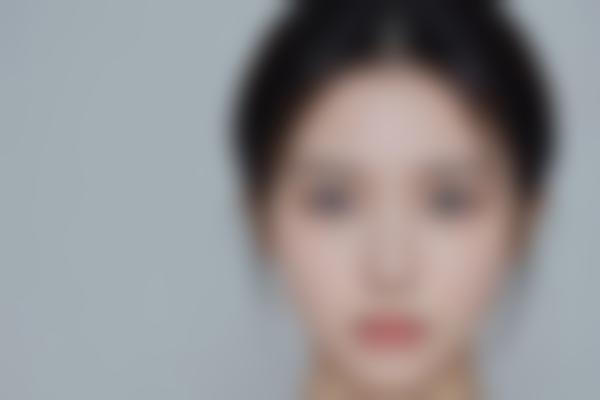 注射美容治疗：的科学选择