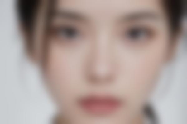 李诗伟医生吸脂手术特点