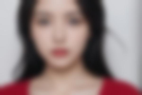 全身吸脂：科学的选择与注意事项
