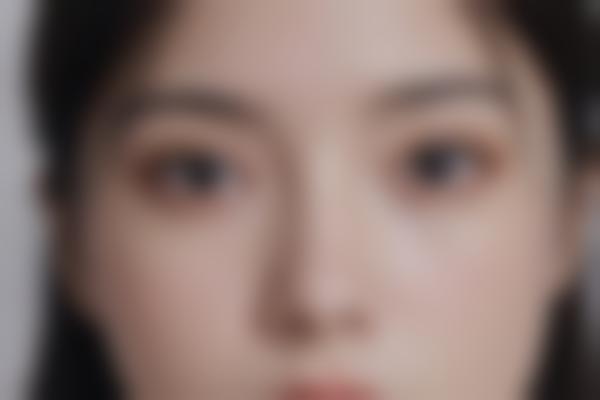 提升手术：重塑自信曲线的指南