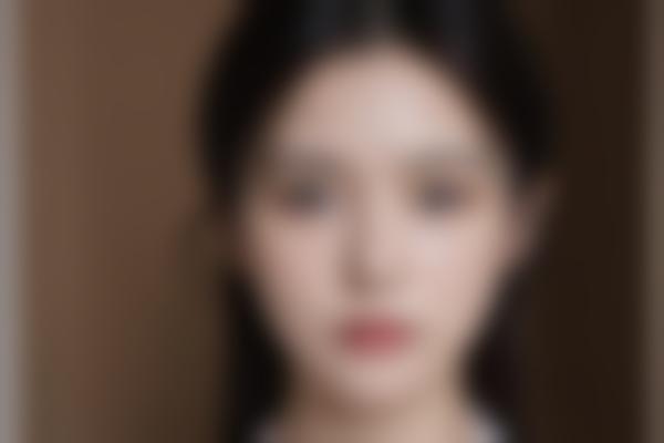 李诗伟医生手术特点
