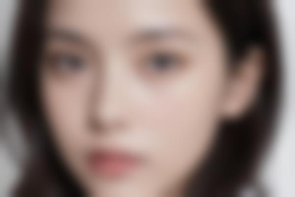 光美容和激光美容有什么区别？一次讲清光子嫩肤、皮秒等热门项目