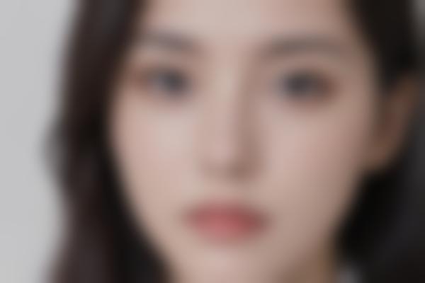 整形修复手术：如何修复不满意的整形？