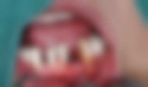 【口腔检查】项目详情