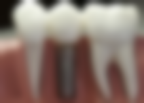 仅1元！深圳美莱口腔门诊部【口腔检查】搞定牙疼/智齿/补牙/牙龈出血问题 