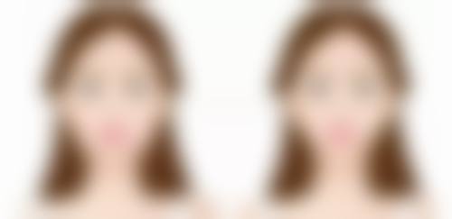 美版热玛吉，分层抗衰新选择