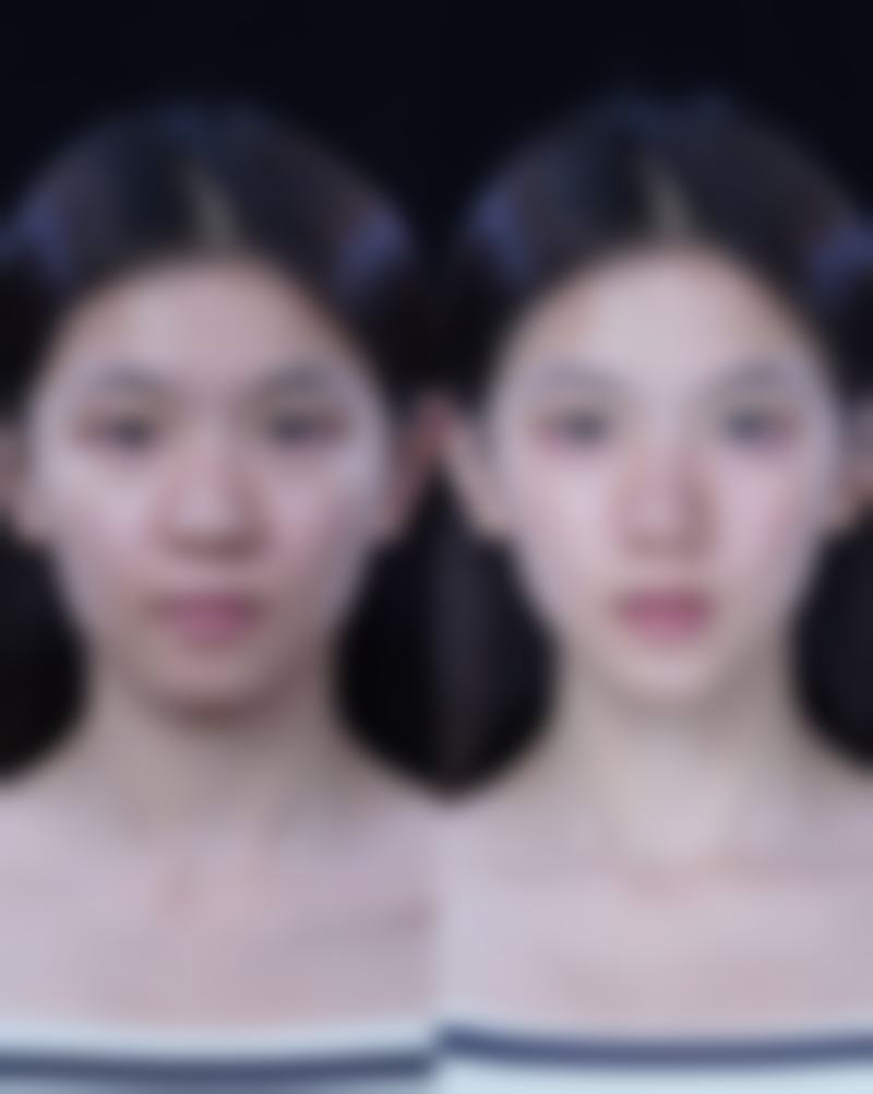 预约优惠活动 - 邵树庆医生医美优惠