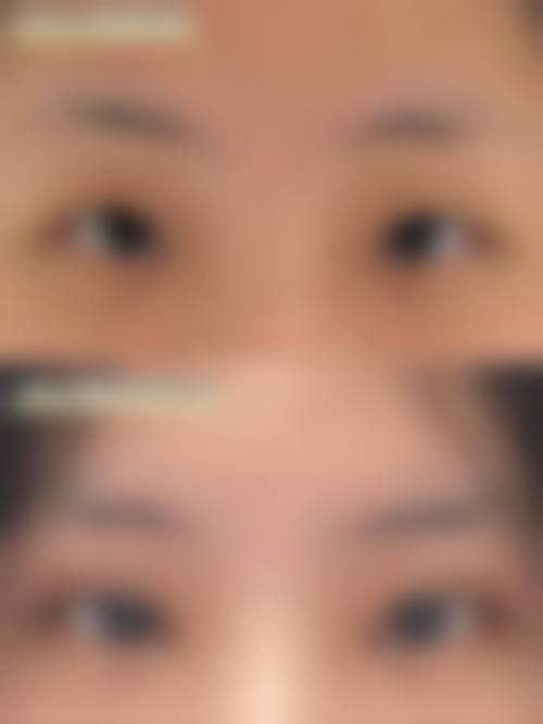 长治城区人民医院整形美容科怎么样求美者反馈