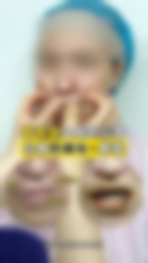 北京煤医医疗美容医院怎么样求美者反馈