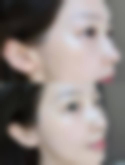 北京丰科星范医疗美容门诊部怎么样求美者反馈