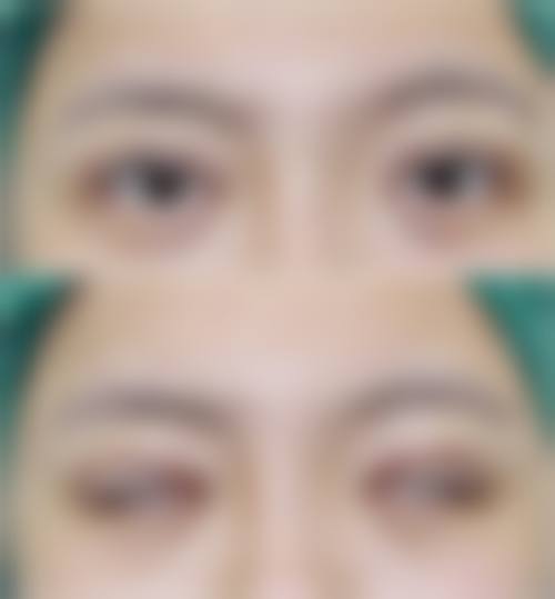 泉州市亿星医疗美容门诊部怎么样求美者反馈