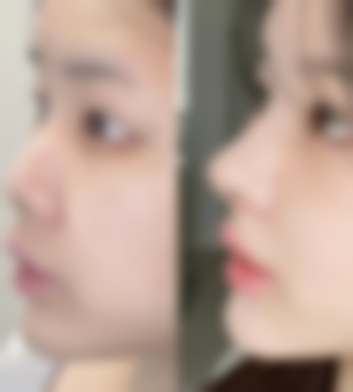 王英勇医生的成功实例