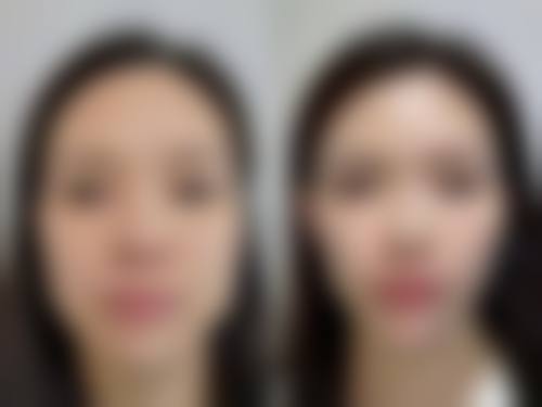 青岛加呗美整形医院怎么样求美者反馈