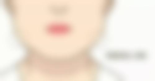 成都正好医学美容整形门诊部怎么样价格收费