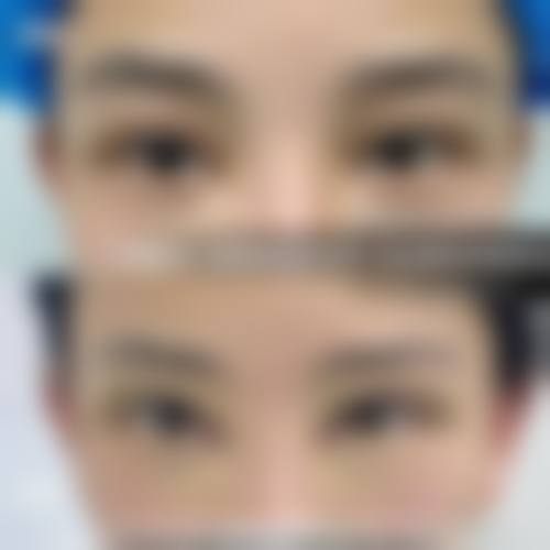 庄洪兴的医美实力展现