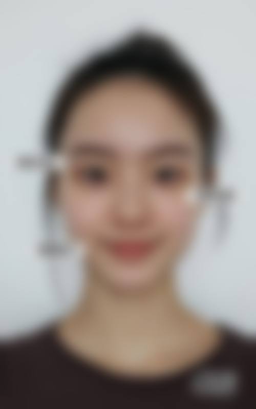 成都臻瑞雅缇丽肤整形医疗美容诊所怎么样求美者反馈