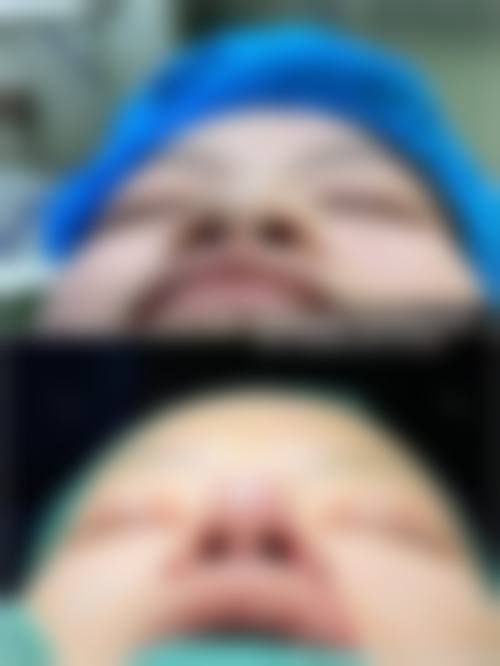 李学雷医生的成功实例