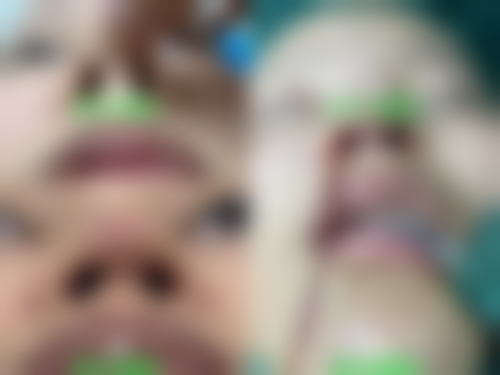 赵丽达擅长的热门整形领域