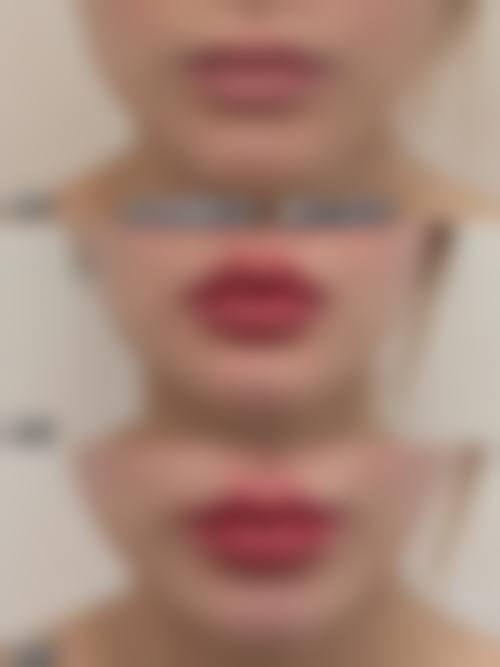 武汉德济医院怎么样求美者反馈