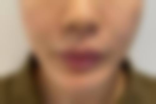 郭卉医生的专精魅力