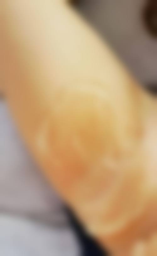 韩国品牌整形外科怎么样价格收费