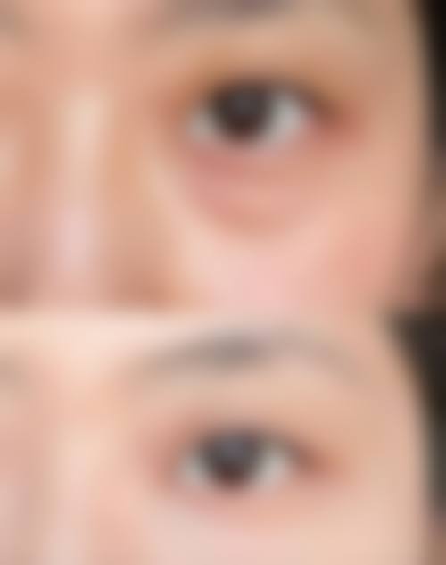 上海容妍整形医院怎么样来院路线