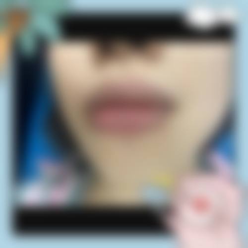 天津星球肌密整形医院怎么样求美者反馈