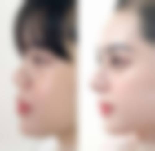 GNG医院怎么样求美者反馈