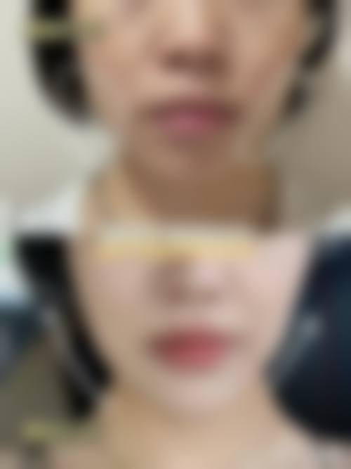 成都正好医学美容整形门诊部怎么样来院路线