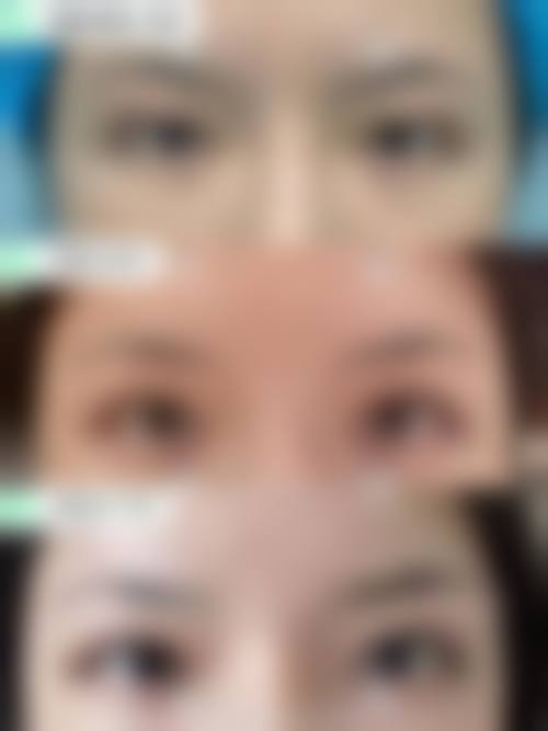 柳州市柳铁中 心医院烧伤整形外科怎么样特色项目及技术优势