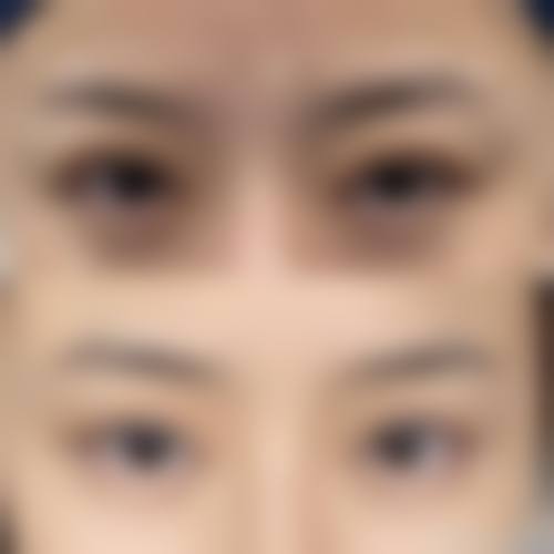 柳州市柳铁中 心医院烧伤整形外科怎么样求美者反馈