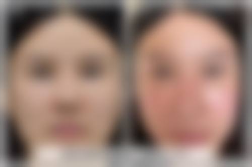 柳州市柳铁中 心医院烧伤整形外科怎么样来院路线