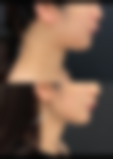 曹镜焕医生擅长的流行项目