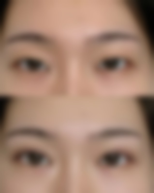 赵丽达的精良整形技术