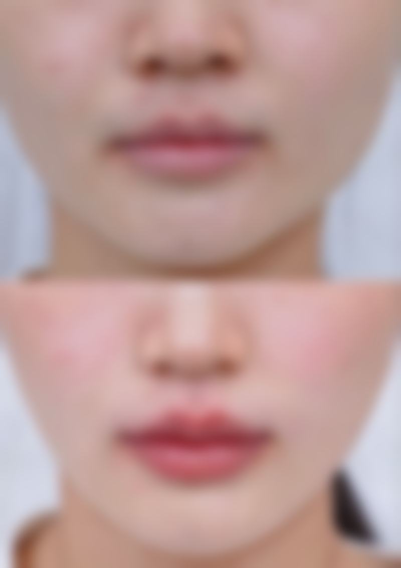 成都臻瑞雅缇丽肤整形医疗美容诊所怎么样价格收费