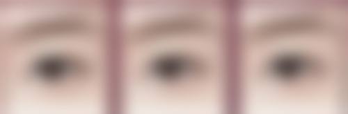 泉州赫尔本医疗美容门诊部怎么样求美者反馈