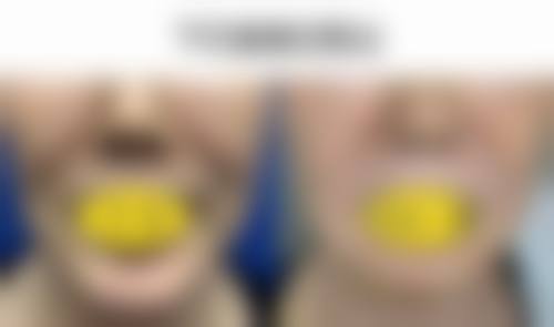 广州合丽美医疗美容怎么样特色项目及技术优势