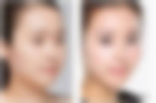 孙凯医生所在的合肥凯婷整形美容医院优势