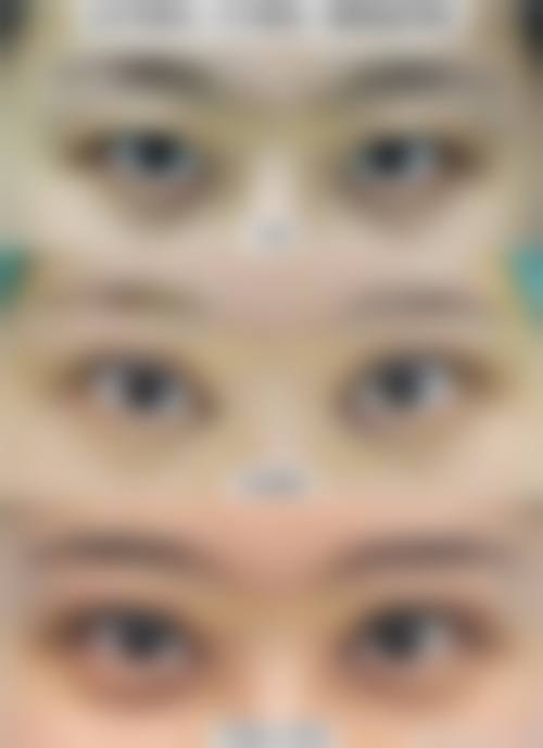 上海复美整形医院怎么样价格收费