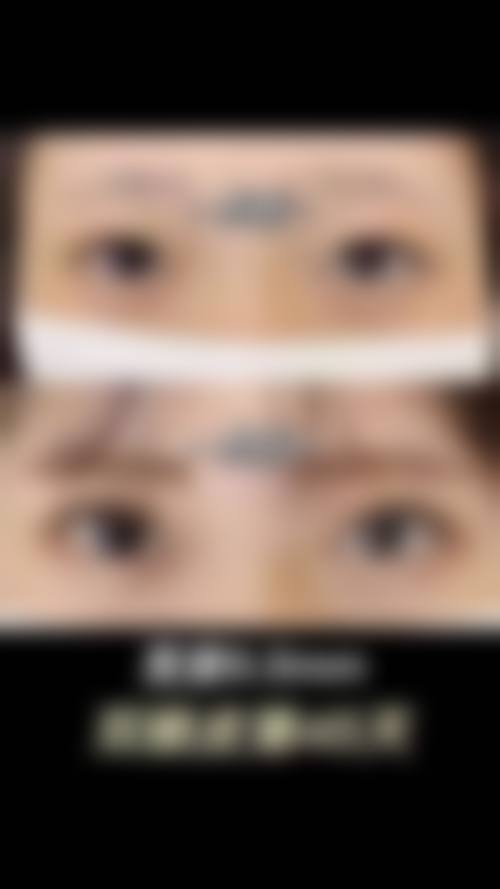 上海复美整形医院怎么样求美者反馈