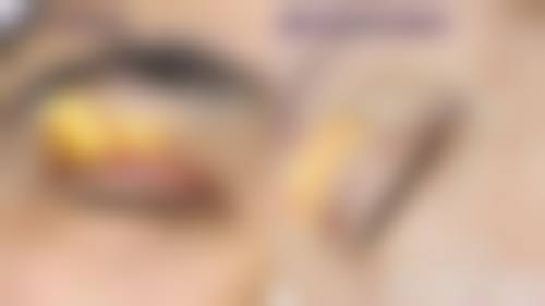 上海韩啸整形医院怎么样来院路线