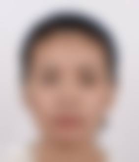 广州苏亚妍雅整形门诊部怎么样医生团队实力