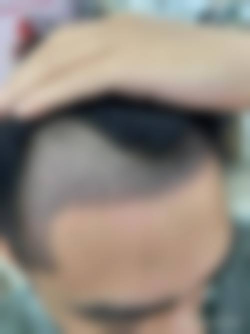 金敬勋引领整形新风尚