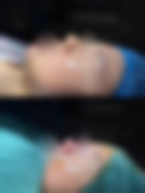 青岛熙朵医疗美容门诊部怎么样价格收费