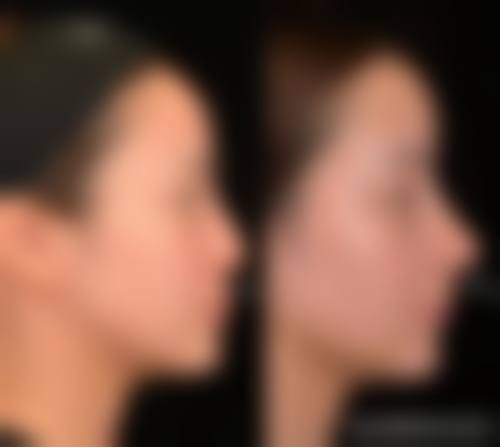 广州合丽美医疗美容怎么样价格收费