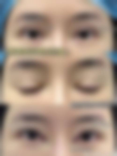 龙昕医生的技术优势