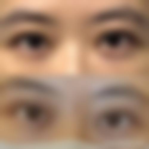 林嘉昕医生擅长多种整形项目