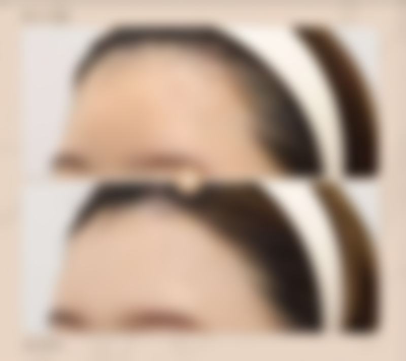 福州时匠整形医院怎么样求美者反馈